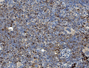 GRB10 Rabbit Polyclonal Antibody