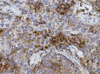 GRB10 Rabbit Polyclonal Antibody