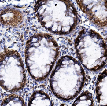 HIF-1 alpha/HIF1A Antibody