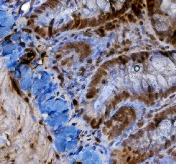 HIF-1 alpha/HIF1A Antibody