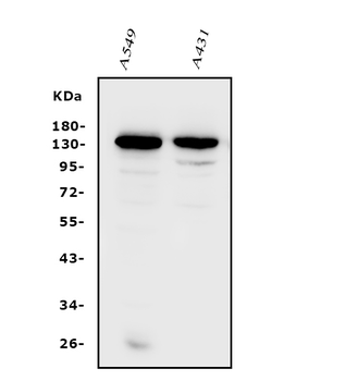 Integrin alpha V/ITGAV Rabbit Polyclonal Antibody