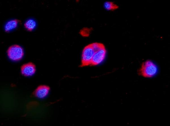 MEK2/MAP2K2 Antibody