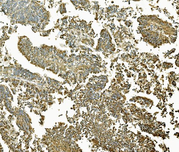 MEK2/MAP2K2 Antibody