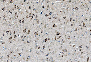 MEK2/MAP2K2 Antibody
