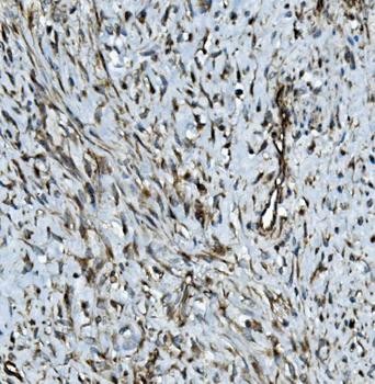 MMP2 Rabbit Polyclonal Antibody