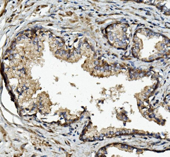 MMP2 Rabbit Polyclonal Antibody