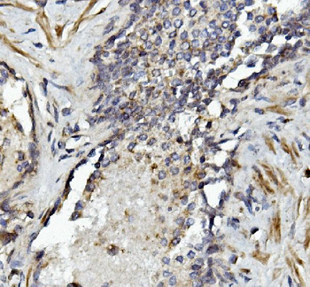 MMP2 Rabbit Polyclonal Antibody