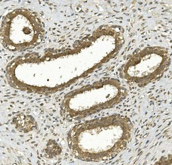 NFE2L2 Rabbit Polyclonal Antibody