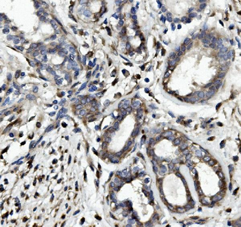 Occludin/OCLN Rabbit Polyclonal Antibody