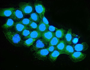OXCT1/SCOT Rabbit Polyclonal Antibody