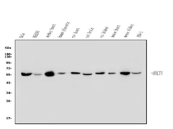 OXCT1/SCOT Rabbit Polyclonal Antibody