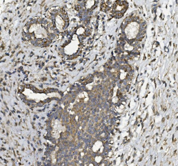 REA/PHB2 Antibody