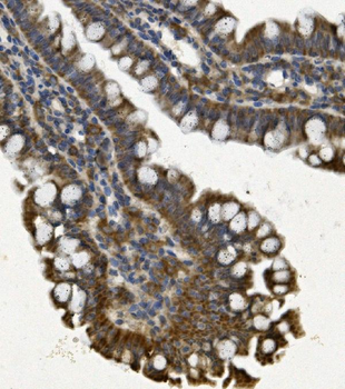 REA/PHB2 Antibody