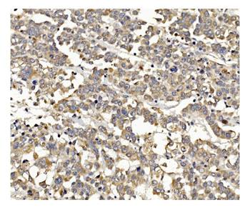 PI3K-gamma/PIK3CG Antibody