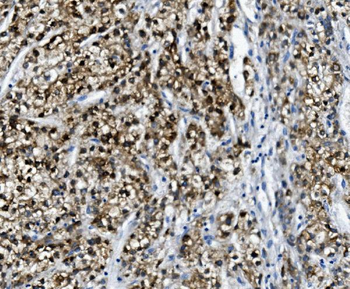 PON1 Rabbit Polyclonal Antibody