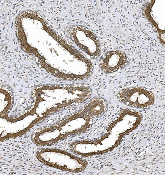 PKC theta/PRKCQ Rabbit Polyclonal Antibody