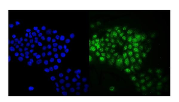 Rab9/RAB9A Rabbit Polyclonal Antibody