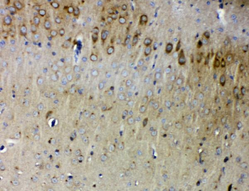 Synaptopodin/SYNPO Rabbit Polyclonal Antibody