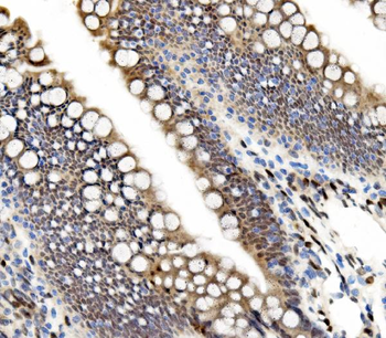 ETF/TEAD2 Rabbit Polyclonal Antibody