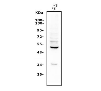 ETF/TEAD2 Rabbit Polyclonal Antibody