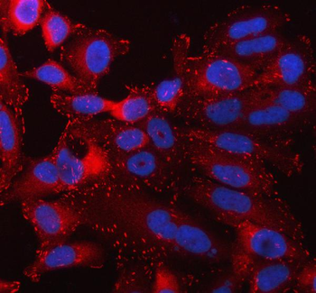 Talin 1/TLN1 Antibody