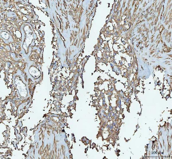 Talin 1/TLN1 Antibody