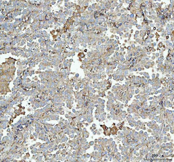 Talin 1/TLN1 Antibody