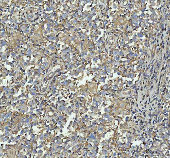 Talin 1/TLN1 Antibody