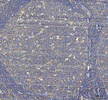 Talin 1/TLN1 Antibody