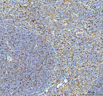 Talin 1/TLN1 Antibody