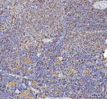 Talin 1/TLN1 Antibody