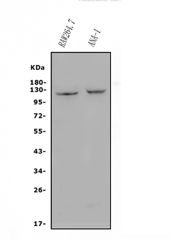 CD30/TNFRSF8 Antibody