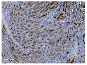UMOD Antibody