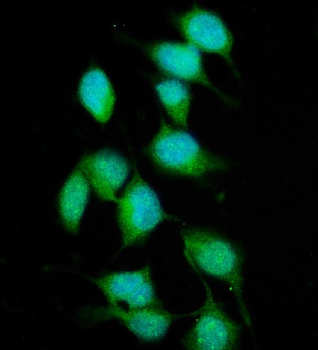 XPC Rabbit Polyclonal Antibody