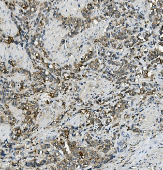 MRP5/ABCC5 Antibody