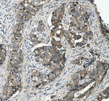 MRP5/ABCC5 Antibody