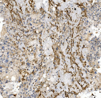 CCR2 Antibody