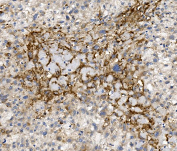 CCR2 Antibody