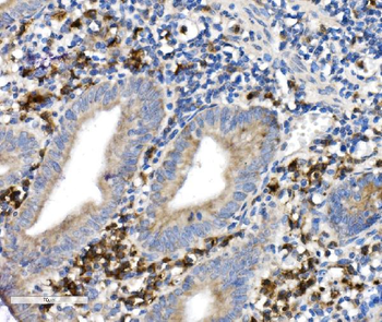 CD38 Antibody