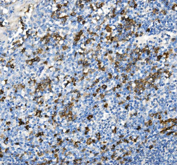CD38 Antibody