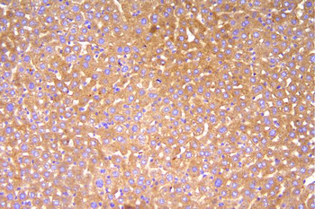 Factor H/Cfh Rabbit Polyclonal Antibody