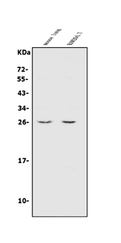 CINP Rabbit Polyclonal Antibody