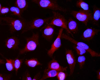 Alpha B Crystallin/CRYAB Antibody