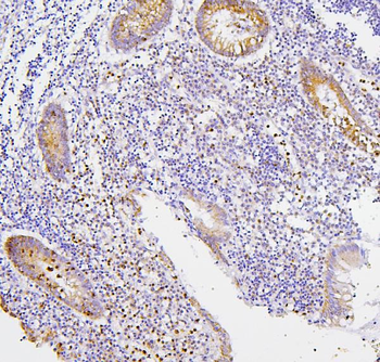 CXCR2 Antibody