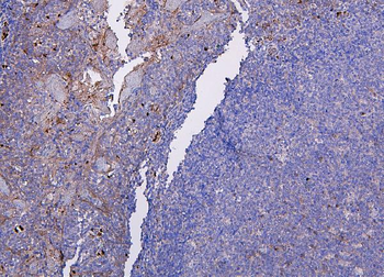 CXCR2 Antibody