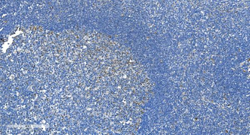 DRP1/DNM1L Antibody
