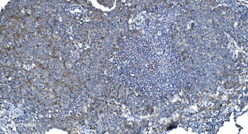 DRP1/DNM1L Antibody