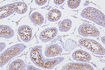 DR1 Rabbit Polyclonal Antibody