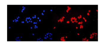 ERM/Etv5 Rabbit Polyclonal Antibody