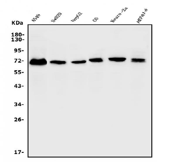 ERM/Etv5 Rabbit Polyclonal Antibody